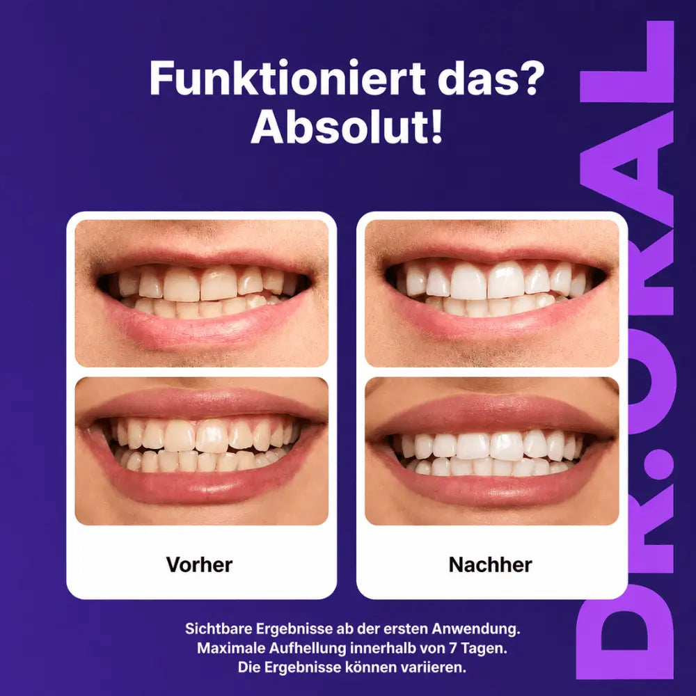 DR. ORAL™ PURPLE WHITENING STRIPS