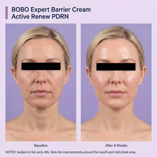 Kigova PDRN + TECA Cream | Firmer, Smoother & Younger-Looking Skin