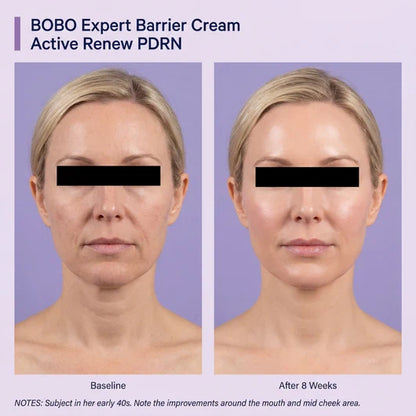Kigova PDRN + TECA Cream | Firmer, Smoother & Younger-Looking Skin
