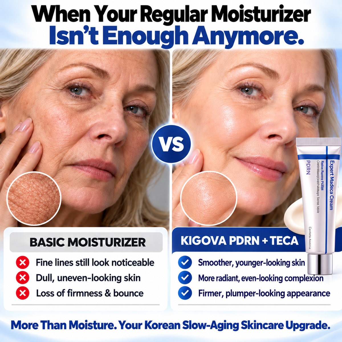 Kigova PDRN + TECA Cream | Firmer, Smoother & Younger-Looking Skin