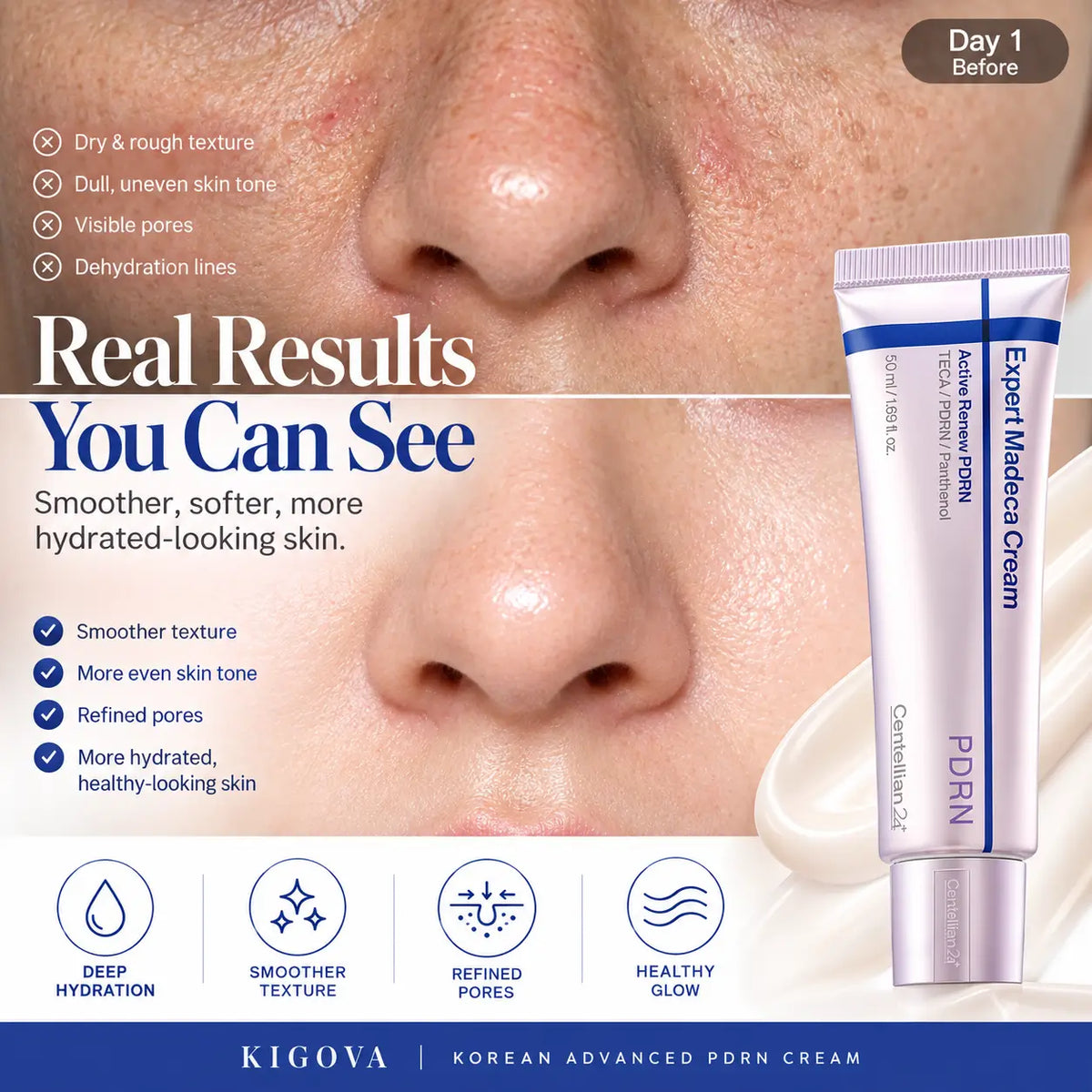 Kigova PDRN + TECA Cream | Firmer, Smoother & Younger-Looking Skin