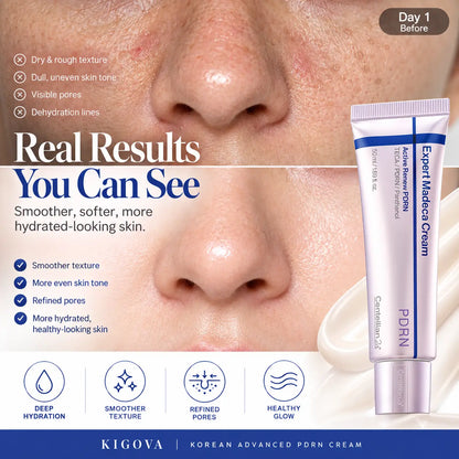 Kigova PDRN + TECA Cream | Firmer, Smoother & Younger-Looking Skin